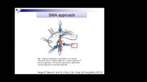 Tips and tricks in Pancreaticoduodenectomy, Artery (SMA) first approach by various route; Prof & HOD, Dr.Nagakawa Yuichi, Tokyo Medical University