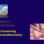Open Pylorus Preserving Pancreaticoduodenectomy