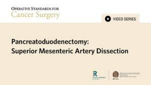 Operative Standards in Cancer Surgery: Pancreatoduodenectomy: Superior Mesenteric Artery Dissection