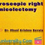 Colon-Laparoscopic Right Hemicolectomy