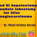 Gall Bladder -Extended Rt hepatectomy