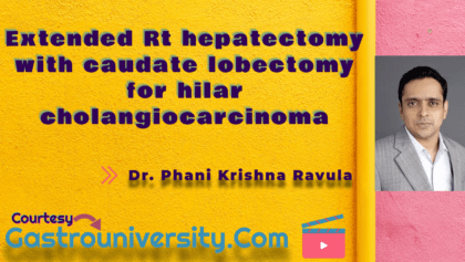 Gall Bladder -Extended Rt hepatectomy