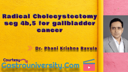 gallbladder cancer