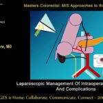 Laparoscopic right colectomy