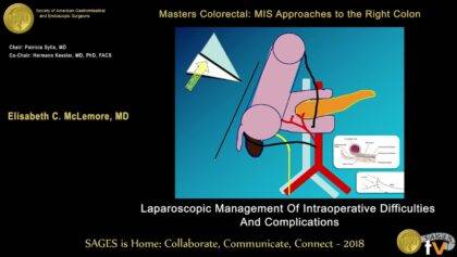 Laparoscopic right colectomy