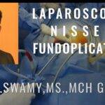 Laparoscopic Nissen Fundoplication