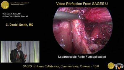 Redo fundoplication