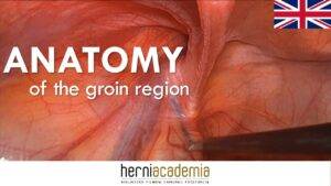 Hernia Surgery - gastrouniversity.com